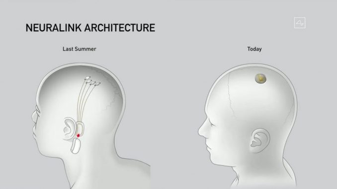 neuralink-update-elon-musk-technology_dezeen_2364_col_0-1024x586